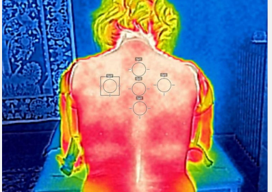 termografia colonna vertebrale termografia lombosacrale