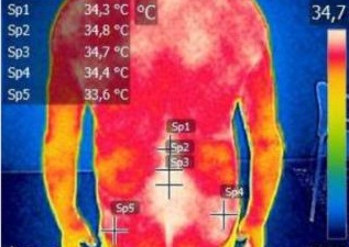 Termografia Medica Termografia Medica Corsi