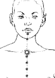 agopuntura asma
