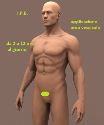 magnete per prostata